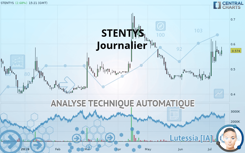 STENTYS - Journalier